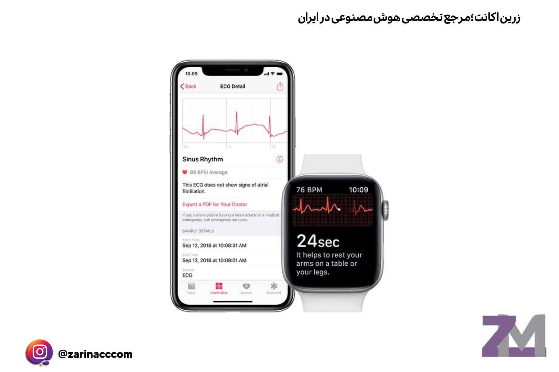 حسگر ECG